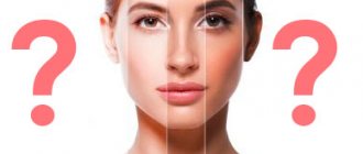 Determining skin undertone